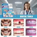 Temporary Tooth Repair Kit, Temporary Teeth Replacement Beads with 4 Shaping Tools, Dental Care Kit Fixing Broken Teeth, Regain Your Smile