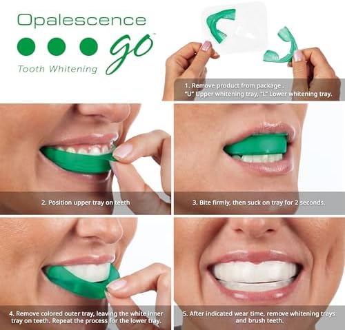 Opalescence Go 15- Prefilled Teeth Whitening Trays - 15% Hydrogen Peroxide - (10 Treatments) Made by Ultradent Products. Teeth Whitening Kit -Mint - 5194-1