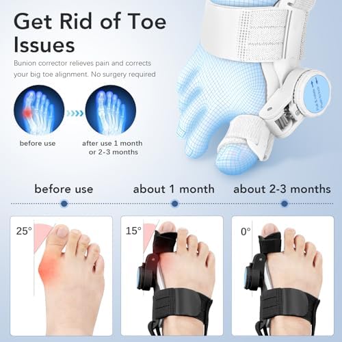 Bunion Corrector for Women Men: Big Toe Straightener Bunion Fix with Adjustable Knob-Orthopedic Bunions Splint Brace Toe Alignment Correction for Hallux Valgus Pain Relief Day/Night 1PCS (Black)