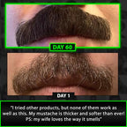 GROW Beard Growth Serum + 2X Biotin Beard Balm – Thickening Conditioner with Castor Oil & Meadowfoam – Fills Patches, Boosts Growth, Softens & Styles – For Thicker, Fuller Men's Facial Hair
