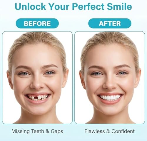 10.9oz Repair Thermoplastic Teeth Beads - Tooth Repair Kit,Moldable False Teeth Beads for DIY Tooth Filling,Moldable Thermal Beads for Halloween Vampire Teeth Fangs