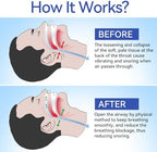 Anti Snoring Devices, Anngola Snoring Solution, Silicone Magnetic Anti Snoring Nose Clip, Effective Hale Breathing Aid, Stop Snoring to Restful Sleep(10 Pack)