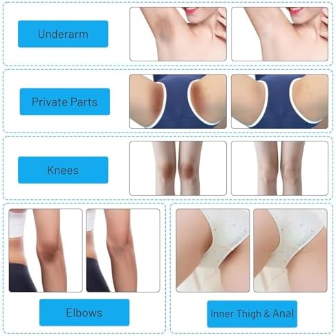 Skin Whitening Cream Skin Bleaching Cream for Body Intimate Area, Private Parts, Underarm, Knees, Elbows, Inner Thigh, Bikini Areas, Armpit, Lightening Dark Spot Remover For Intimate Part 2 OZ