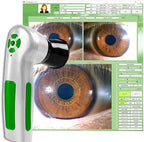 2.0 MP USB Portable Iridology Camera, Iris Analyzer with 12MP HD 30X Iris Lens and Driver-Free Analysis Software for Health Center, Spa