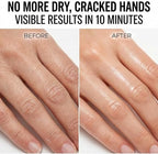 WONDER FAMILY Hand Mask – Moisturizing Gloves for Dry Cracked Hands – Collagen Overnight Hand Masks, Hand Moisturizer Cotton Gloves for Sleeping Alternative, Repairing Treatment for Women & Men