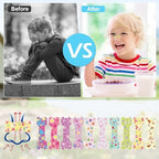 30 Count Small Size Kids Nose Strips 1.73 * 0.55 Girls Breathing Strips Nasal Strips for Snoring Cartoon Nasal Strips for Kids Sleeping Tape Anti Snoring Solution Nose Tape Nose Strips