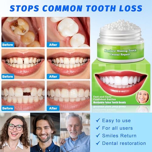 Moldable False Teeth Beads - Temporary Tooth Repair Kit | Fix Broken, Chipped Teeth, Cavity Temporary Fillings, Missing Tooth Gaps & Loose Dentures Within Minutes at Home