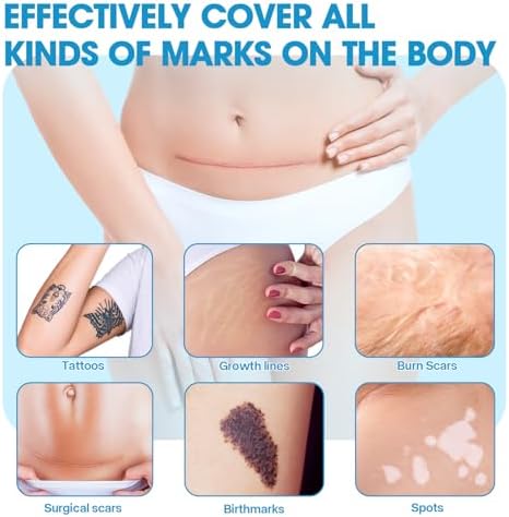 10pcs Tattoo Cover Up Patch, Invisible Tattoo/Scars/Concealer Sticker, Waterproof Sweat-Proof Ultra-Thin Concealer, Natural Skin Color Scars Cover Up Tape (Light Skin Tone)