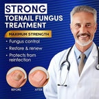Toenail Fungus Treatment Extra Strength – VTROUY 2 Bottle Nail & Toe Solution with Undecylenic Acid 25% and Tea Tree Oil 15ml 2Pcs