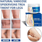 Varicose Veins Cream for Legs - Gentle with Natural Ingredients, Suitable for Most Skin Types 50G/1.76 OZ