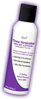 Naturasil Tinea Versicolor Treatment Lotion - Max-Strength 10x Sulfur Lotion for Fast-Acting Antifungal Relief | Soothes and Restores Skin Health 113g