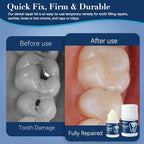 Zinc Oxide Eugenol Dental Care Kit, Tooth Repair Kit, Temporary Tooth Filling Repair Kit, Tooth Filler, Cavity Filler, Dental Cement Glue Adhesive for Crowns, Bridges, Teeth, Home Dental Emergency Fix