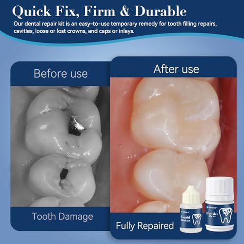 Zinc Oxide Eugenol Dental Care Kit, Tooth Repair Kit, Temporary Tooth Filling Repair Kit, Tooth Filler, Cavity Filler, Dental Cement Glue Adhesive for Crowns, Bridges, Teeth, Home Dental Emergency Fix