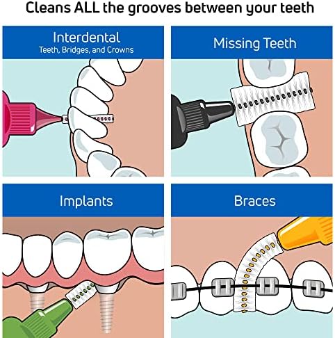 TePe Interdental Brush Original, Soft Dental Brush for Teeth Cleaning, Pack of 25, 0.45 mm, Extra-Small/Small Gaps, Orange, Size 1
