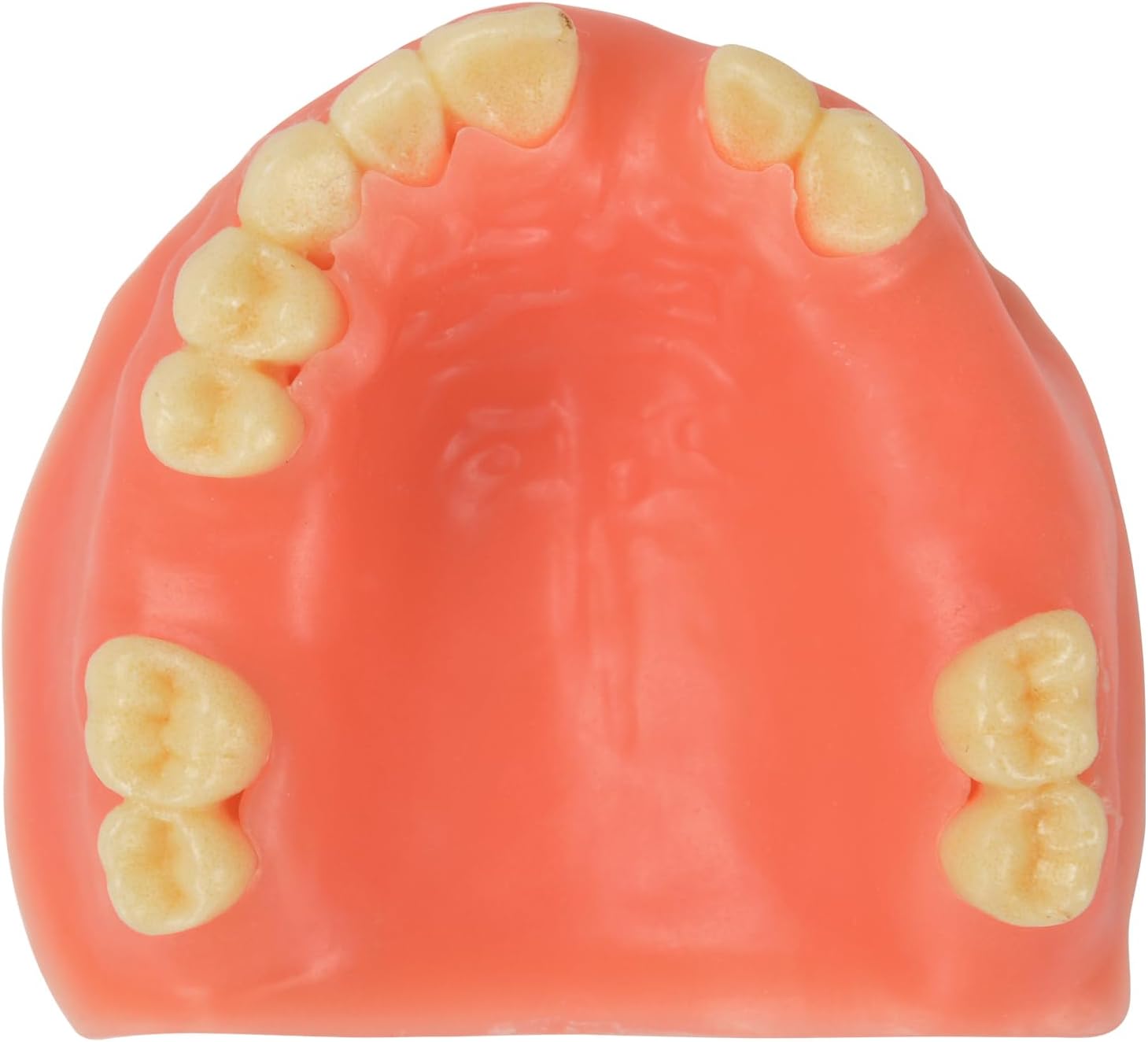 Ultrassist Maxillary Dental Implant Model Missing Partial Teeth, Basic Implant Training Model with Practice Soft Gums, Great Dental Training Tooth for Dental Implant Practice