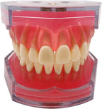 Standard Teeth Model, Dental Crown Models Soft Gums, Dental Model Resin Removable Full Mouth Teeth for Tooth Extraction Exercises, Doctor Explains to The Patient
