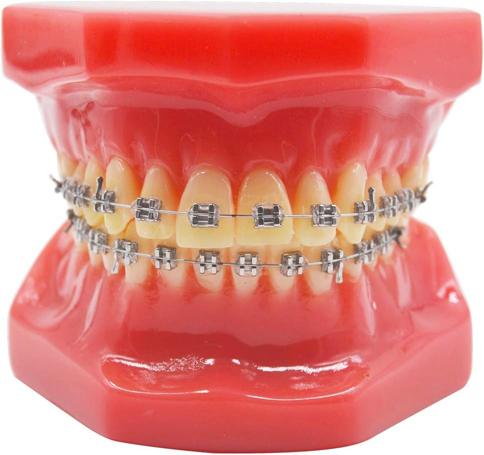 Dental Orthodontic Metal Brcket with Typodont Teeth Model