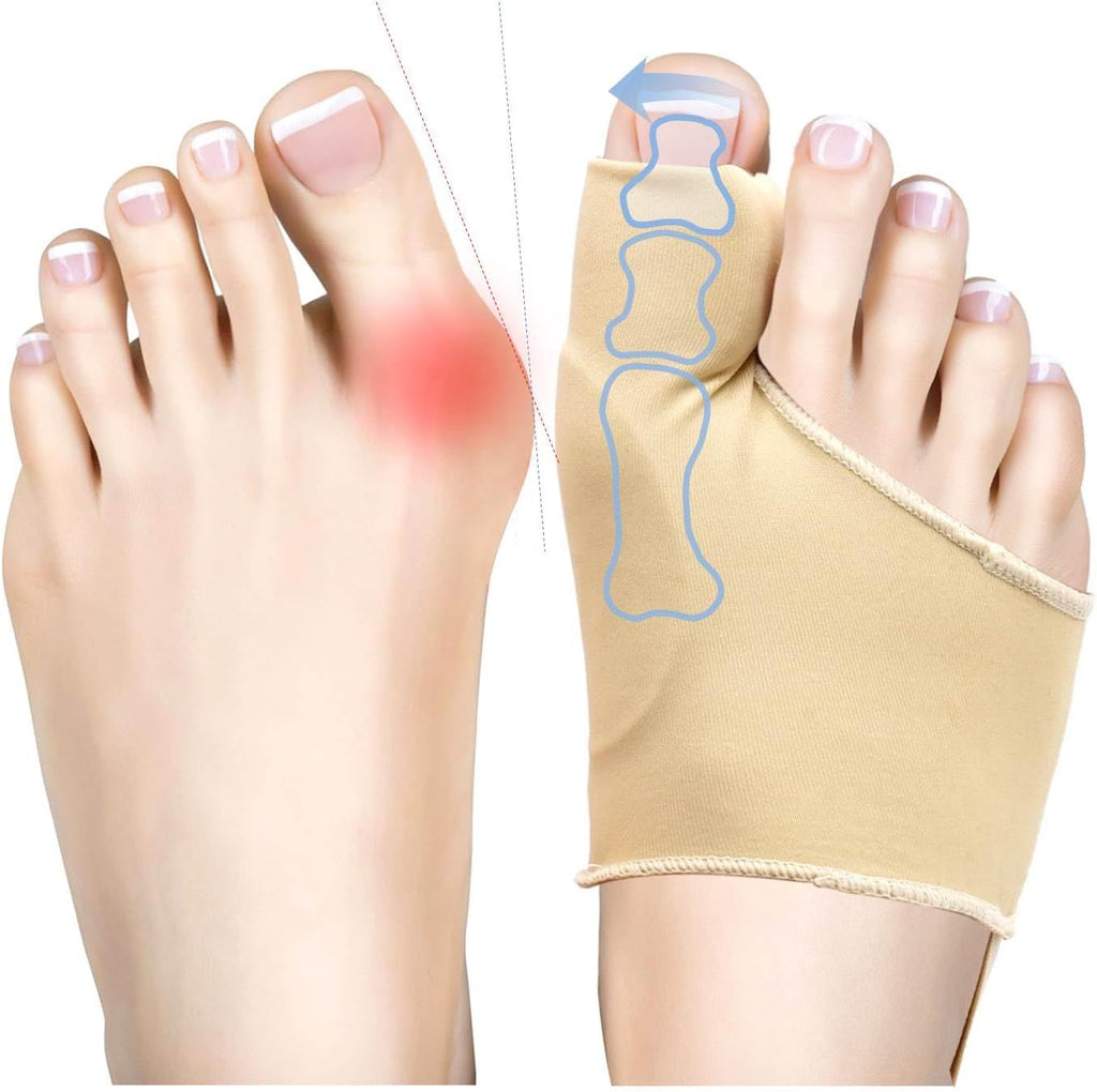 Bunion Corrector Sleeve, Orthopedic Toe Splint for Pain Relief, 2 Pack, Beige (2, Beige)