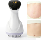 Lymphatic Drainage Massager & Anti-Cellulite Massage Tool, Body Contouring Device for Legs, Arms & Stomach, Supports Smoother Skin, with Gentle Warming & Vibration - W