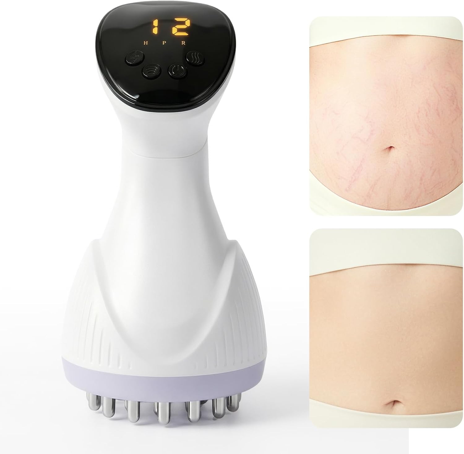 Lymphatic Drainage Massager & Anti-Cellulite Massage Tool, Body Contouring Device for Legs, Arms & Stomach, Supports Smoother Skin, with Gentle Warming & Vibration - W