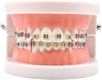 Angzhili 1 Piece Dental Demonstration Orthodontic Model with Metal Wires and Bracket (Metal Bracket)
