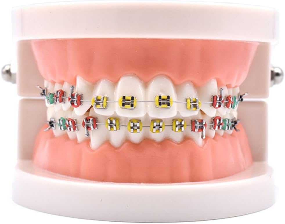 Angzhili 1 Piece Dental Demonstration Orthodontic Model with Metal Wires and Bracket (Metal Bracket)