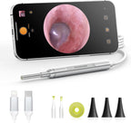 Digital Otoscope Compatible with iPhone and Android Devices, HD Ear Camera with Ear Wax Removal Tools, Video Ear Scope Otoscope with Light, Capture Photos and Videos (Silver)