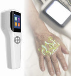 IInfrared Vein Finder, Transilluminator Vein Locator Viewer, Portable Illumination Visualization Lights for Nurses, Imaging of Veins for IV Phlebotomy (Hand-Held)