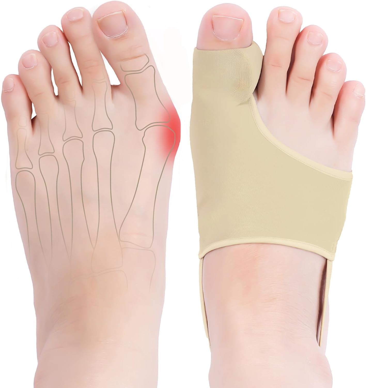 2PCS Bunion Corrector for Women & Men, Comfortable Big Toe Straightener with Pads & Splint, Hallux Valgus Pain Relief for Day & Night Support with Anti-slip Strap(Beige,1 Pair)