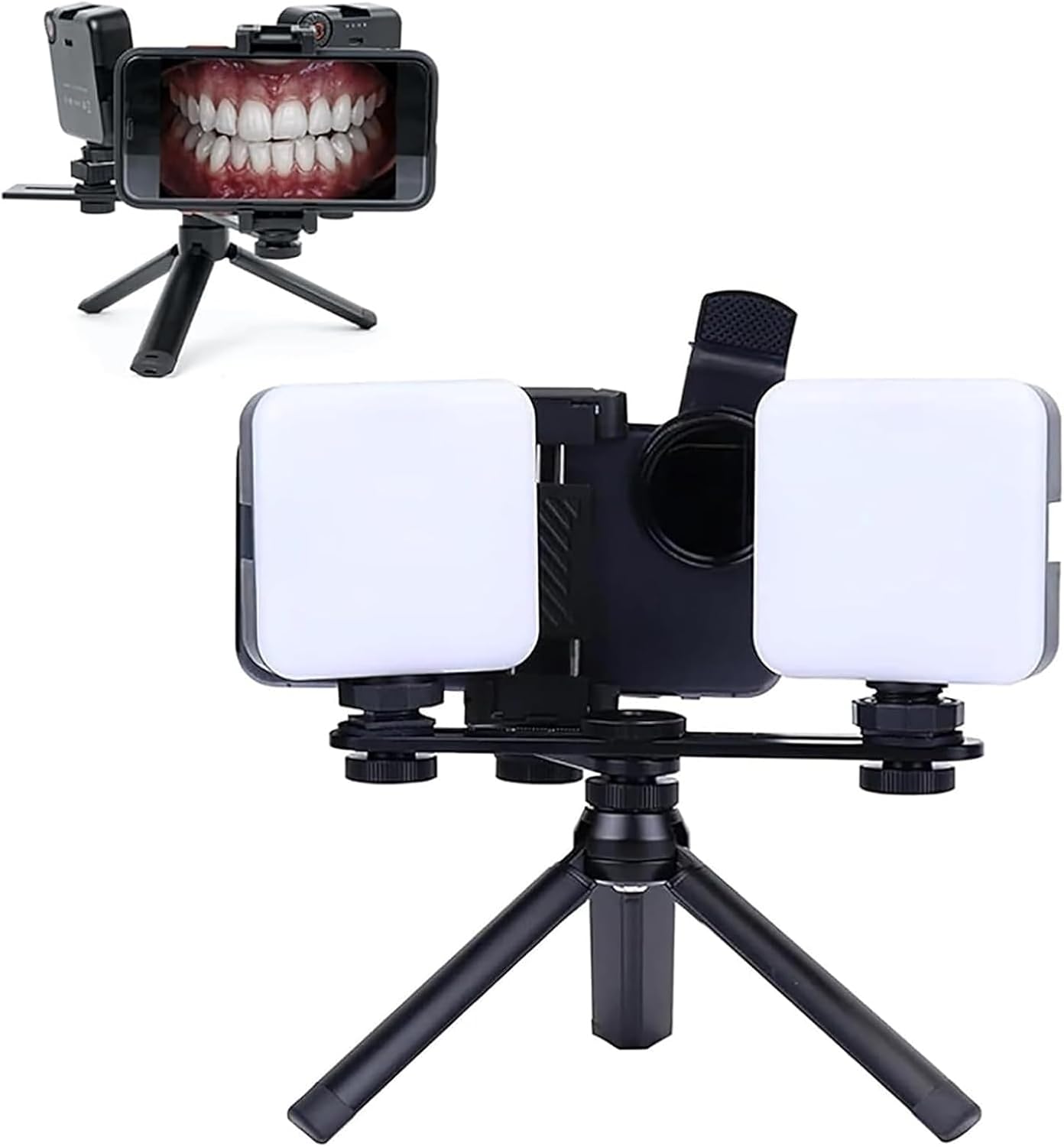 TsoLay Dental Handpiece Fill Light, 2500MAH Dental Photography Aid with Removable Bracket, 6000k Color Temperature and Lighting Brightness Adjustment, 120° Lighting Angle for Hospital