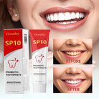 2 Pcs SP10 Probiotic Whitening Toothpaste, Deep Cleaning Care Remove Yellow Tooth Stains, with Probiotic Oral Health Management, Fresh Breath.