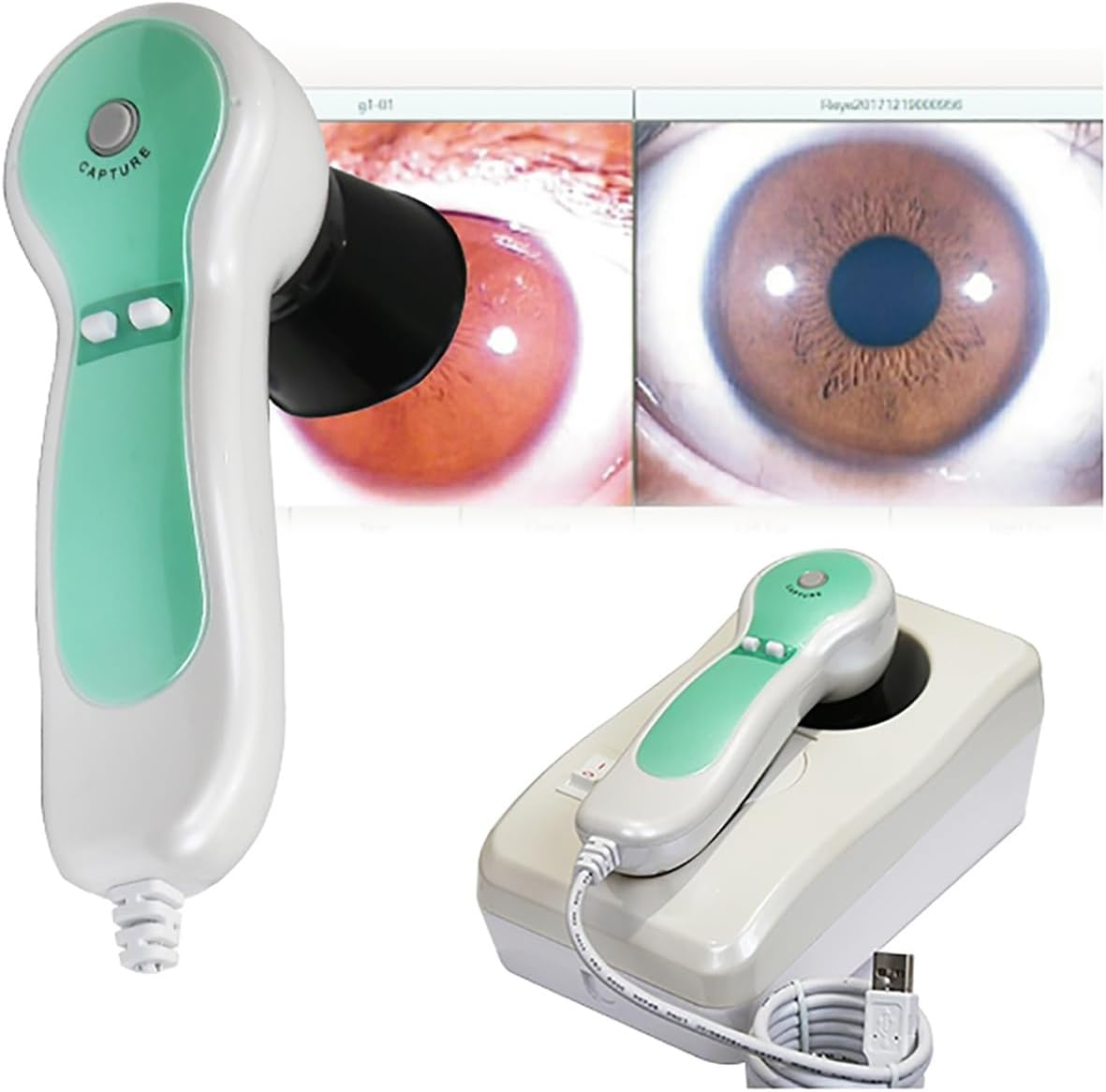 Iriscope Iridology Camera Analyzer, Iridology Camera, Iris Eye Detector, HD 30X Adjustable Lens, With Aluminum Box + HD 5 Million Pixel + Iris Analysis Software
