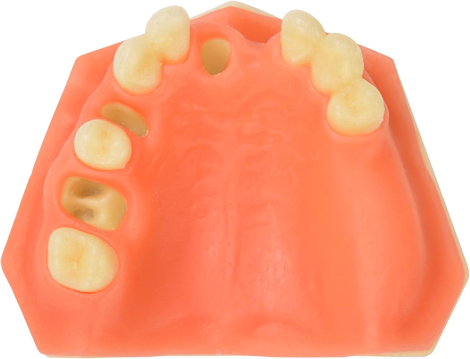 Ultrassist Dental Implant Training Practice Maxillary Model with Sinus, Basic Implant Training Model with Practice Soft Gums, Great Dental Training Tooth for Dental Implant Practice