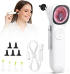 ScopeAround Otoscope with Light, 1.45" IPS Display Digital Otoscope, 3.9mm Ear Camera with Ear Wax Removal Tools, Ear Scope with Extention Cable, 6 LED Lights, Capture Photos Videos, White