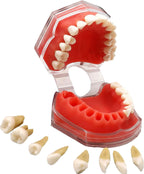 Standard Teeth Model, Dental Crown Models Soft Gums, Dental Model Resin Removable Full Mouth Teeth for Tooth Extraction Exercises, Doctor Explains to The Patient