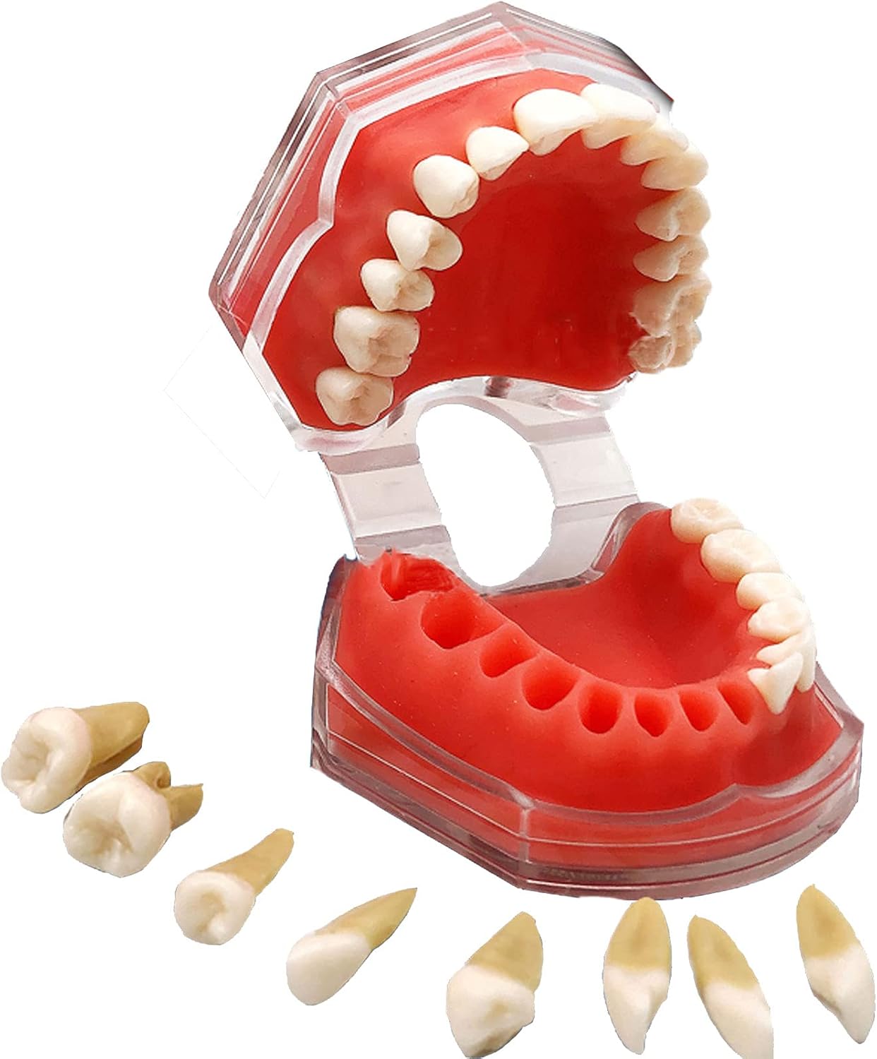 Standard Teeth Model, Dental Crown Models Soft Gums, Dental Model Resin Removable Full Mouth Teeth for Tooth Extraction Exercises, Doctor Explains to The Patient
