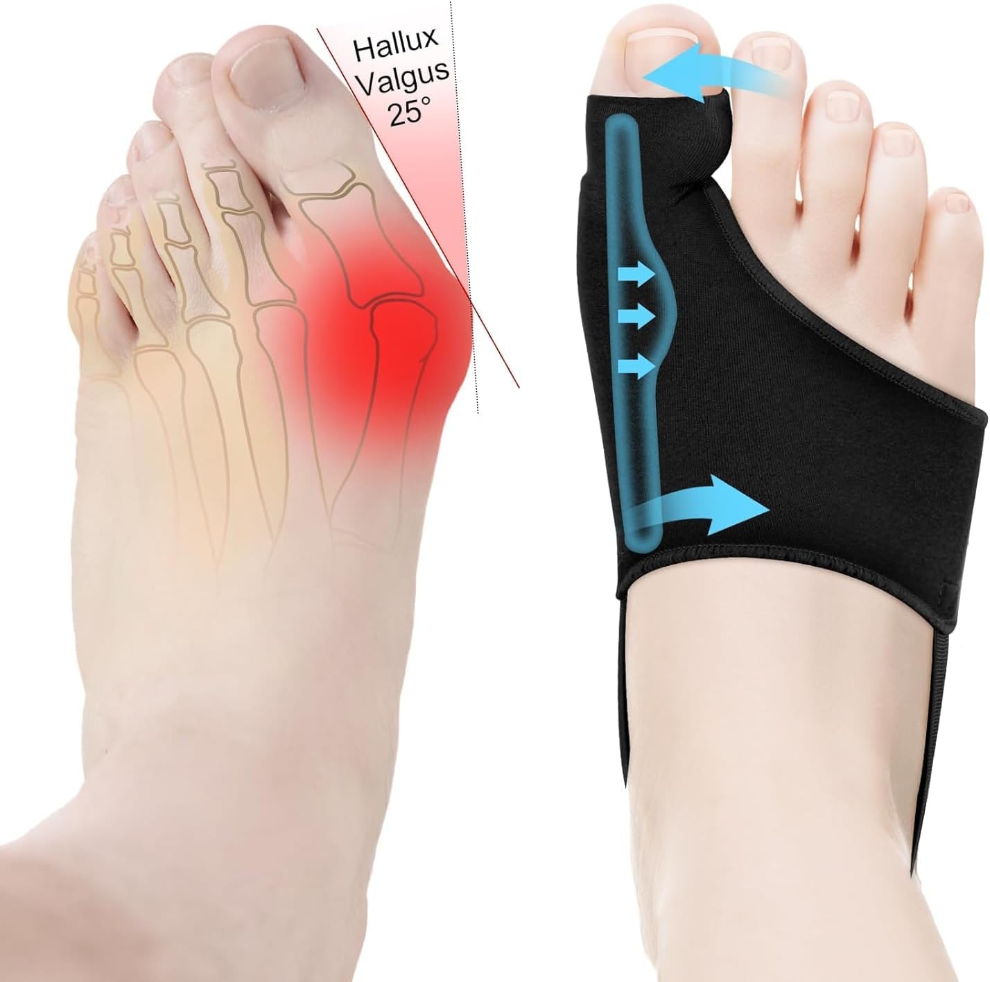 2PCS Bunion Corrector for Women & Men Big Toe Straightener - Bunions Correction Tool for - Bunion Splint with Soft Pads - Hallux Valgus Pain Relief, Breathable Fabric for Day & Night Wear