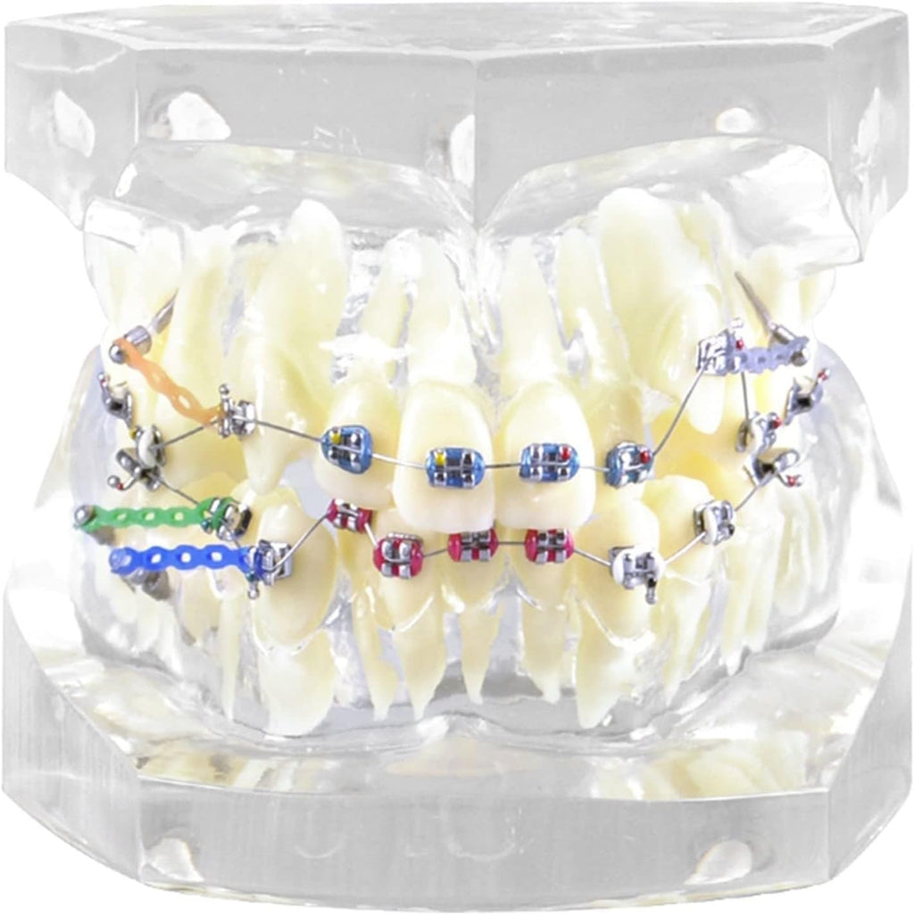 Dental Orthodontic Typodont Teeth Model with Metal Brackets and Ligature Ties for Teaching and Practice