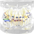 Dental Orthodontic Typodont Teeth Model with Metal Brackets and Ligature Ties for Teaching and Practice
