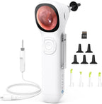 ScopeAround Digital Otoscope w/Built-in Screen, Manual-Focus Digital Otoscope with Light for Home Use, No App Needed, Easy Viewing for Everyday Ear Checks, Otoscope Camera, White