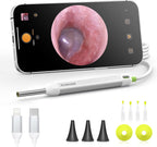 Digital Otoscope with Gyroscope, HD Ear Camera with Ear Wax Removal Tools, Video Ear Scope Otoscope with Light, Compatible with iPhone and Android (Silver)
