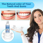 Temporary Snap on Veneers Dentures for Men and Women, Natural Nice-Looking Top and Bottom Dentures Fake Teeth, Comfort Fit Your Smile in Minutes