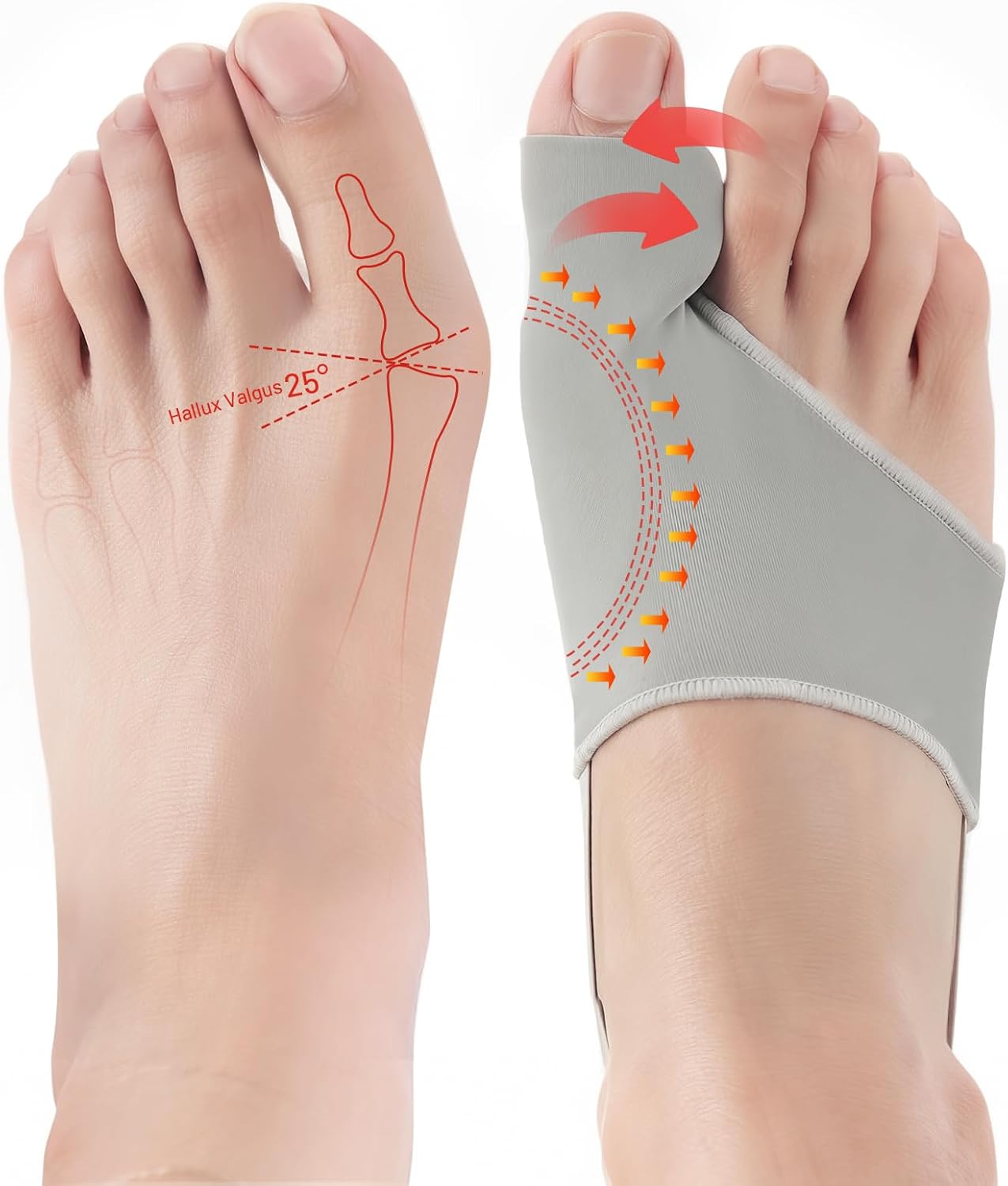 Bunion Corrector for Women & Men, Big Toe Nighttime Support - Adjustable Toe Straightener for Hallux Valgus, Bunion Pain Relief, Hammertoe, Overlapping Toes - Wear Inside Shoes All Day & Night (Gray)