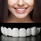 2 Pairs Adjustable Cosmetic, Realistic Lifelike Fit for Men & Women, Comfortable Upper & Lower Smile Covers (White)