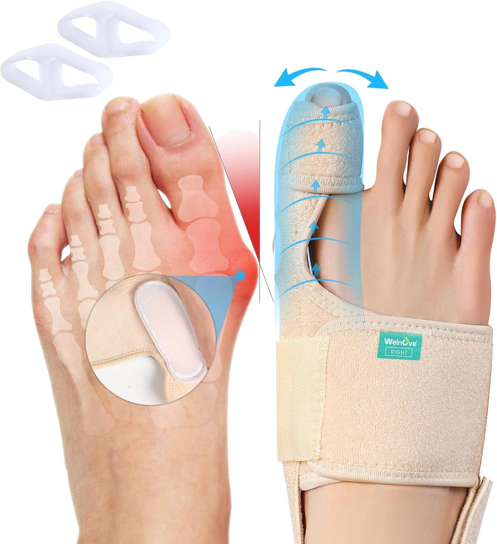 Welnove Bunion Corrector Women & Men Big Toe: 1 Pair Bunion Splint - Adjustable Bunion Correction - Toe Straightener with Non-slip Strap, Day Night Support (Beige) - With 2 Gel Separators