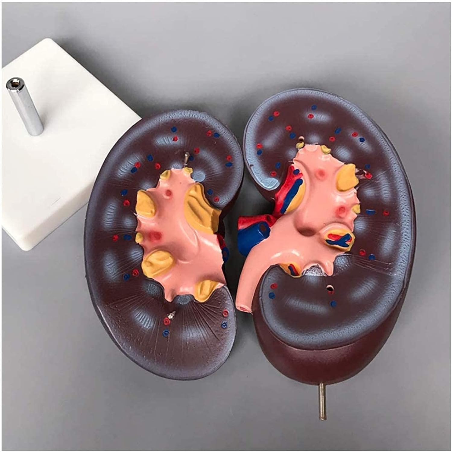 Anatomy Model 2X Magnification Human Kidney Model - Medical Kidney Model Human Organ Model Detachable Kidney Structure Adrenal Gland for Study Teaching for Medic