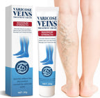 Bellisinno Varicose Veins Treatment for Legs, Varicose Veins Cream for Spider Veins, Relaxing Leg Cream Formula to Improve Circulation, Soothe Tired Legs and Reduce Heaviness