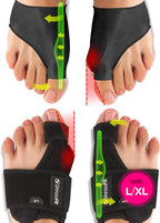 Effective Bunion Corrector for Men & Women | Relief Kit with Cushion Sleeves | Toe Straightener – Large/X-Large