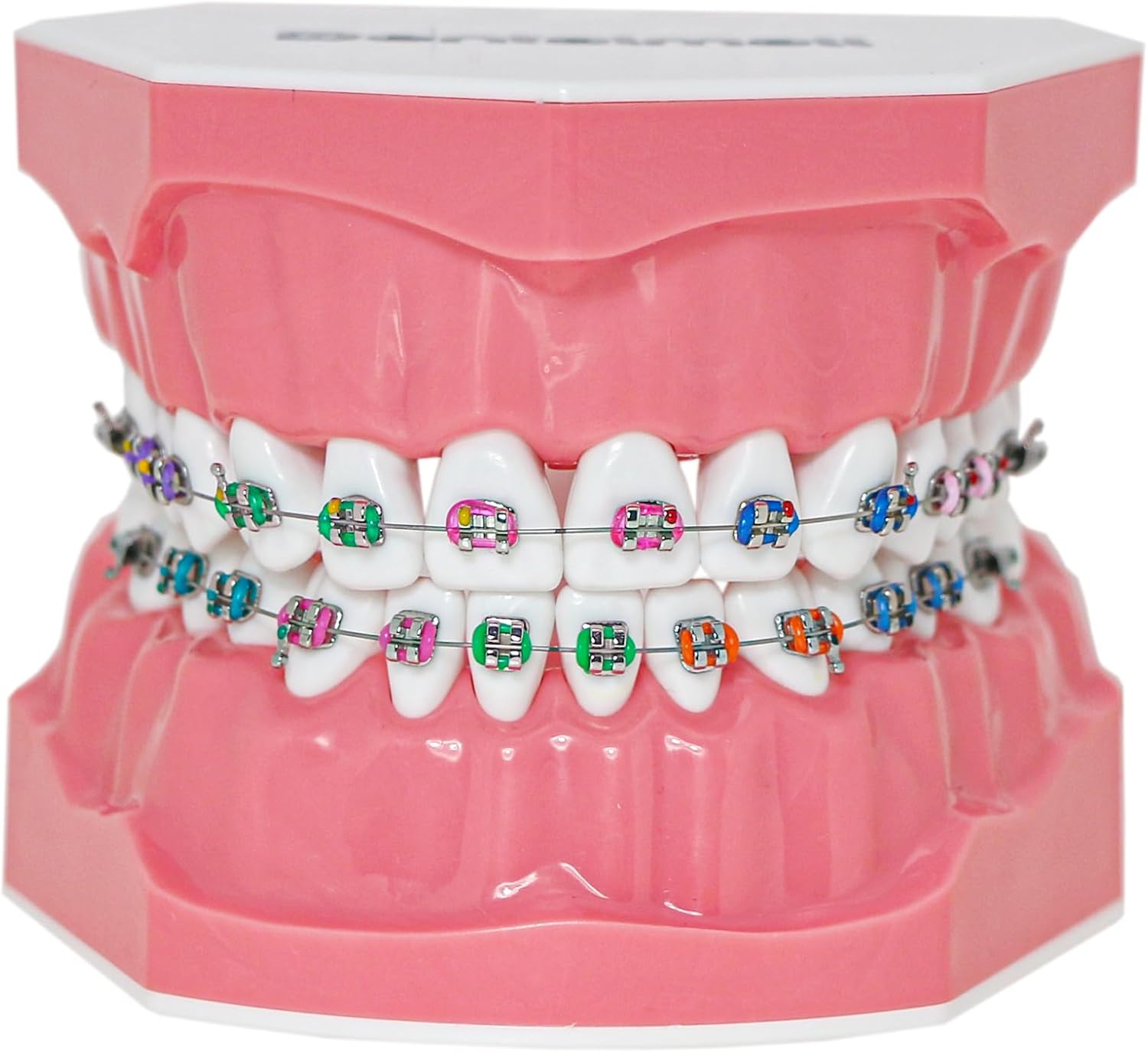 Typodonts Orthodontics Demonstration Model with Metal Wires and Bracket Teaching, Learning, Interpretation Model for Adults and Children (Metal Bracket)