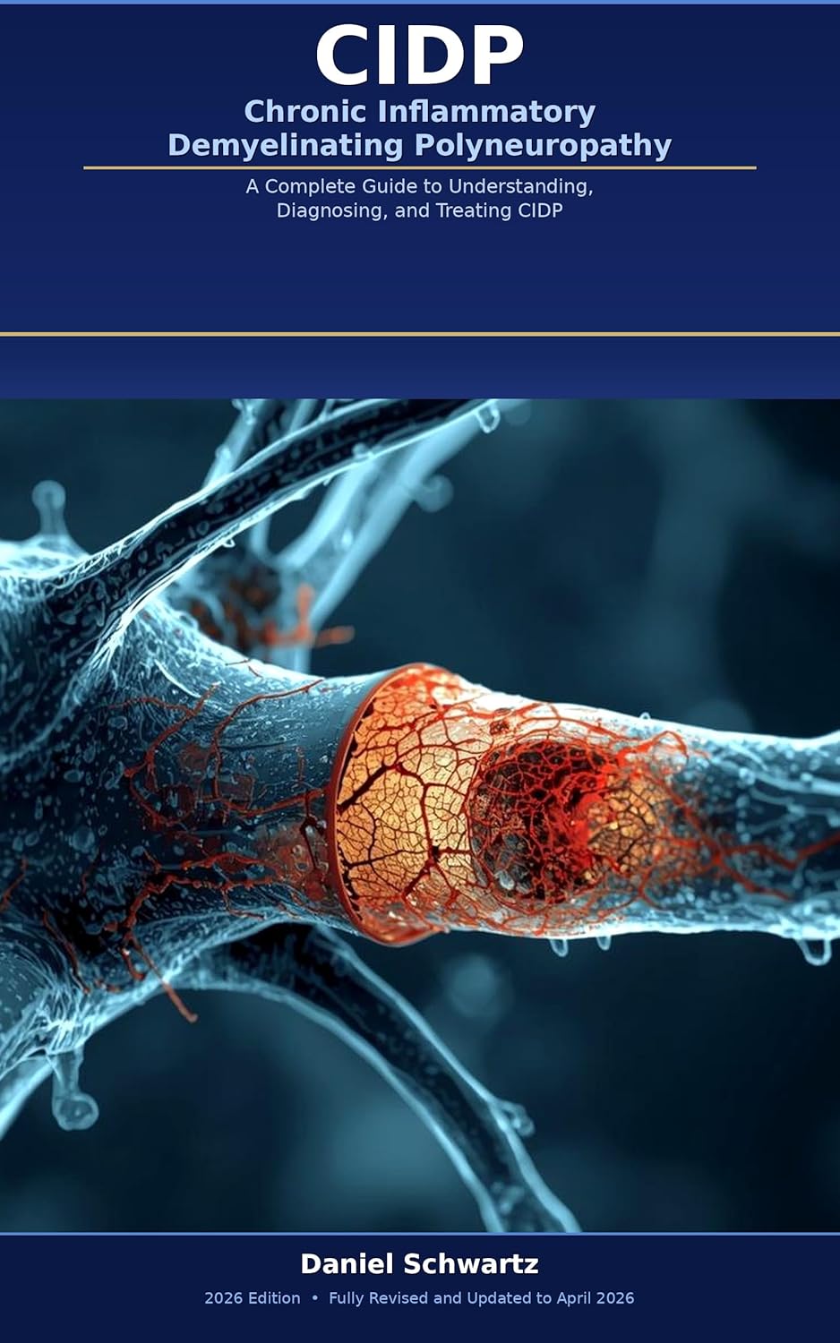 CIDP - Chronic Inflammatory Demyelinating Polyneuropathy: A Complete Guide to Understanding, Diagnosing, and Treating CIDP (Medicine, Health, and Self-Help Book 2)